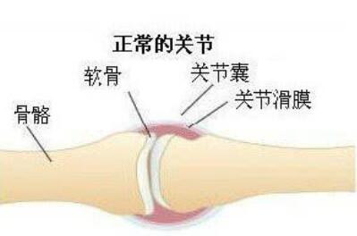 成都类风湿检查：血液检查免疫情况与鉴别疾病