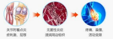 成都类风湿专病专治医院：类风湿尿液检查是查什么?
