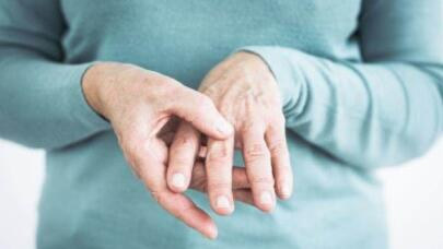类风湿关节炎能根源治疗吗？针刀镜技术成类风湿患者福音！