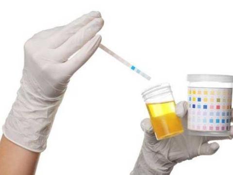 在成都去哪里看高尿酸？尿酸高一定会痛风吗?